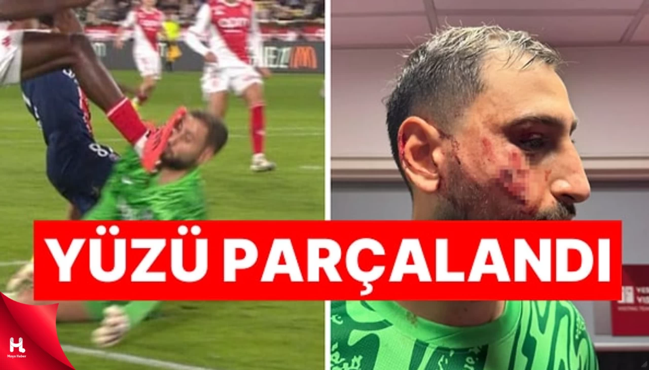 Fransa Ligi'nde Şoke Eden Olay: Kalecinin Yüzü Parçalandı!