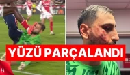 Fransa Ligi'nde Şoke Eden Olay: Kalecinin Yüzü Parçalandı!