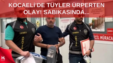 Kasap Dükkanında Bir Çocuğu Yaralamıştı, Kabarık Sabıkası Şoke Etti!