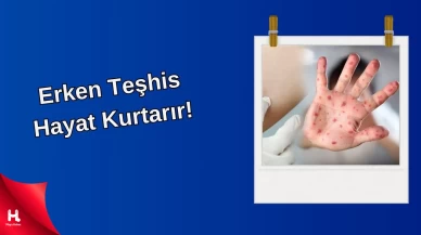 Bağışıklığınız zayıfsa dikkat: O hastalık kapınızı çalabilir