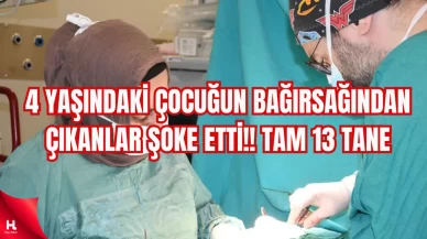 4 yaşındaki çocuğun bağırsağından çıkanlar şoke etti!! Tam 13 tane