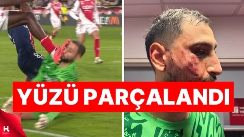 Fransa Ligi'nde Şoke Eden Olay: Kalecinin Yüzü Parçalandı!