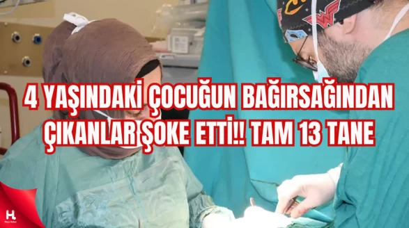 4 yaşındaki çocuğun bağırsağından çıkanlar şoke etti!! Tam 13 tane